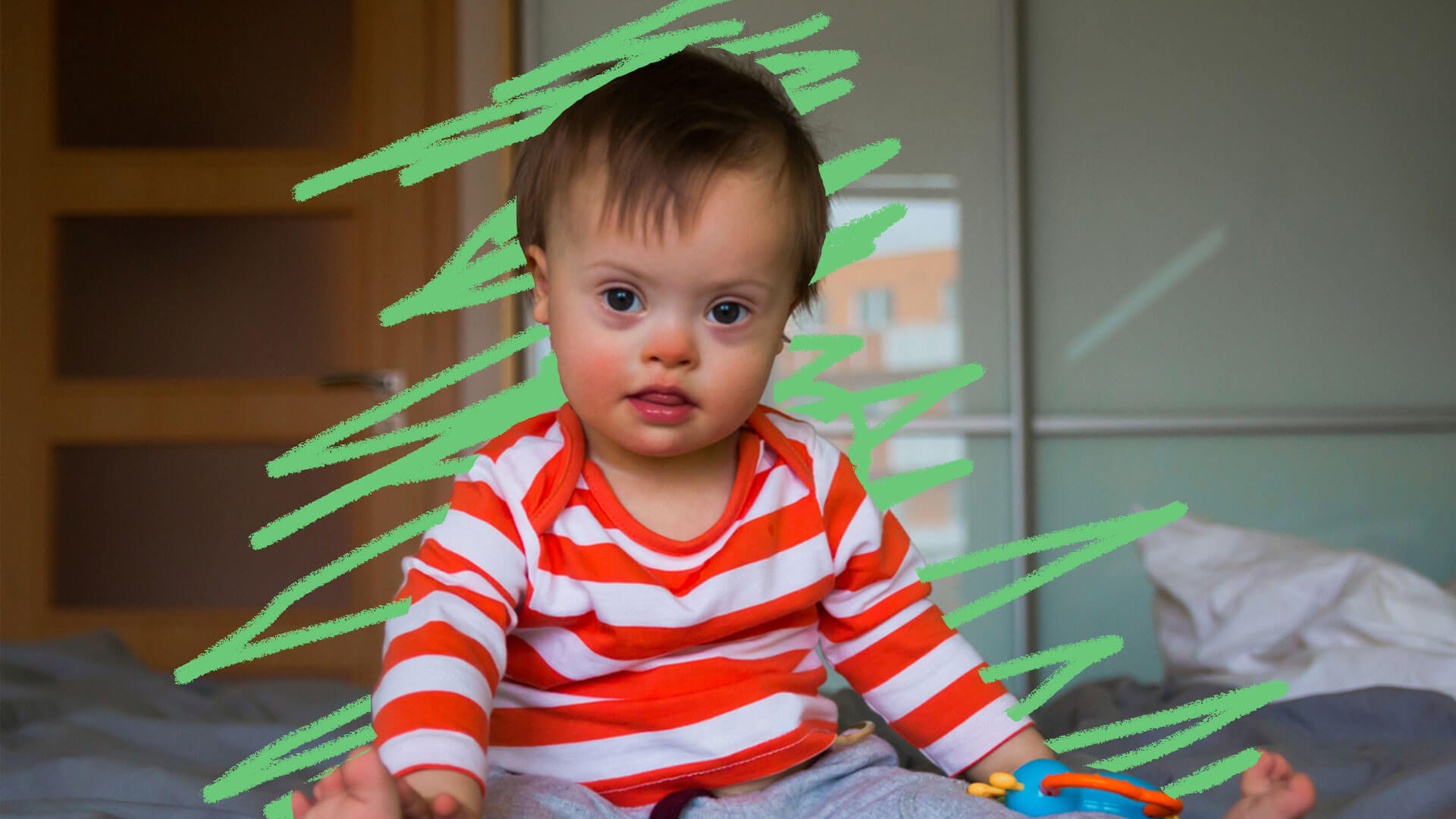 Filho com Síndrome de Down: foto de uma criança que está com blusa listrada branca e laranja.