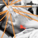 Foto em preto e branco mostra mulher deitada na maca, com as duas mãos no rosto.