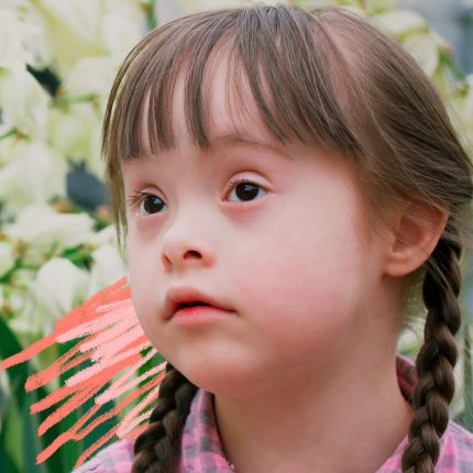 Imagem de uma criança com deficiência. A menina com síndrome de Down e tranças no cabelo está com expressão de reflexão e olhos atentos