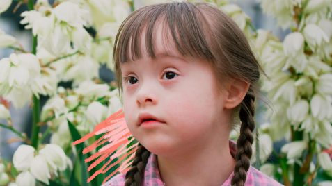 Imagem de uma criança com deficiência. A menina com síndrome de Down e tranças no cabelo está com expressão de reflexão e olhos atentos