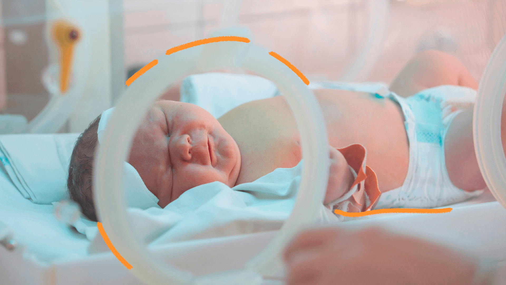 Imagem mostra um bebê branco em uma incubadora hospitalar. A matéria fala sobre a relação das eleições e a mortalidade infantil.